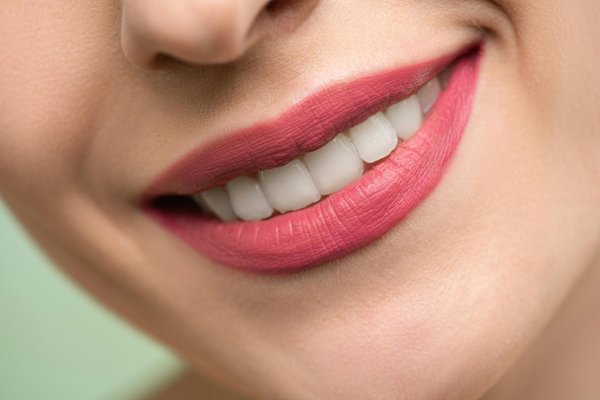 Unlock your perfect pout: lip fillers in London explained